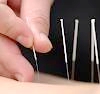 Needles Insertion
